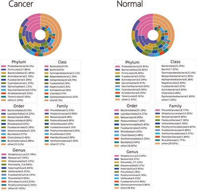 Characterization of Microbiota in Cancerous Lung and the Contralateral Non-Cancerous Lung Within Lung Cancer Patients